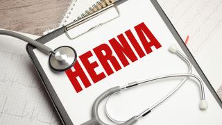 Judge To Meet Hernia Mesh MDL's Lawyers For 2023 Trial