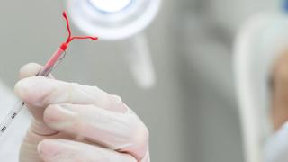 ParaGard MDL: Master Complaint Proposed For Direct Filing