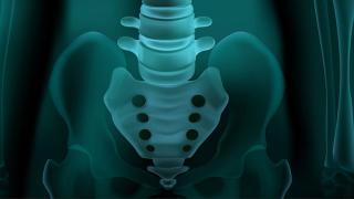 Two Jury Verdicts Worth $83M Over Pelvic Mesh Reversed